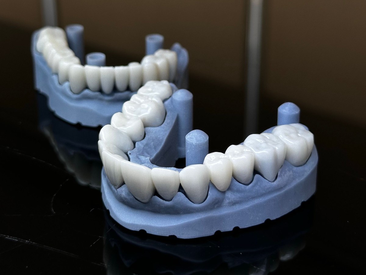 3D-printed dental models on a dark reflective surface