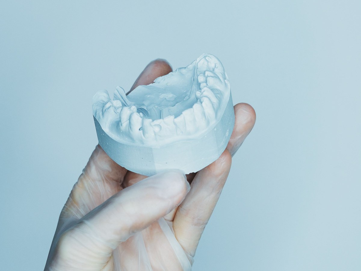 Gloved hand holding a blue stone model of the teeth