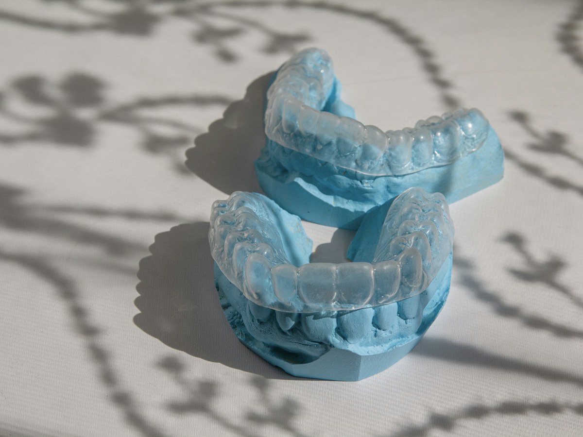 Clear aligner trays resting on blue dental models
