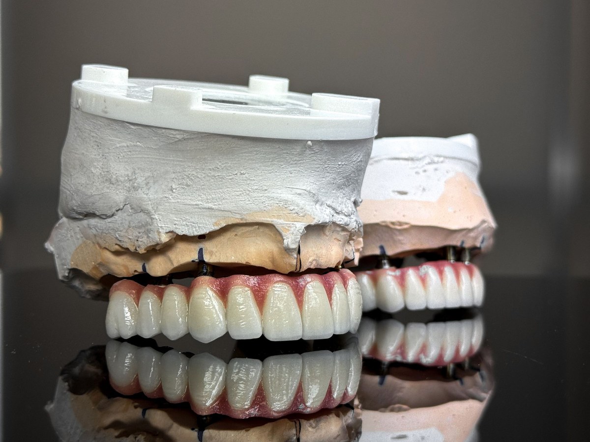 Full dentures on dental models reflected on a black surface