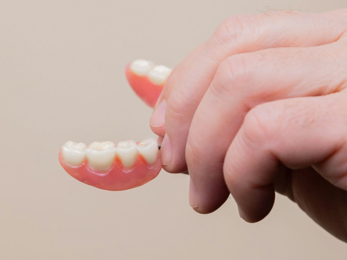 Hand holding a partial denture used to replace missing teeth