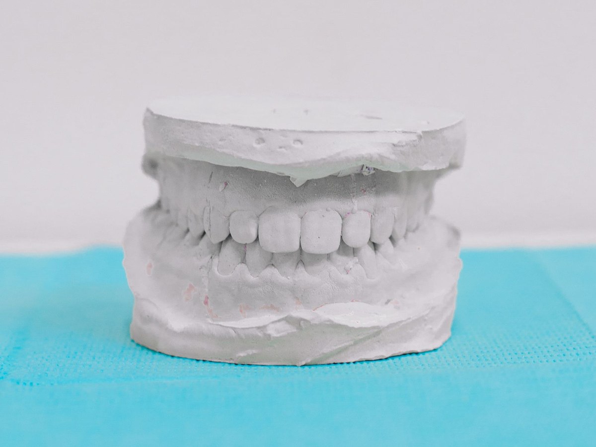 Plaster model of the upper and lower teeth biting together