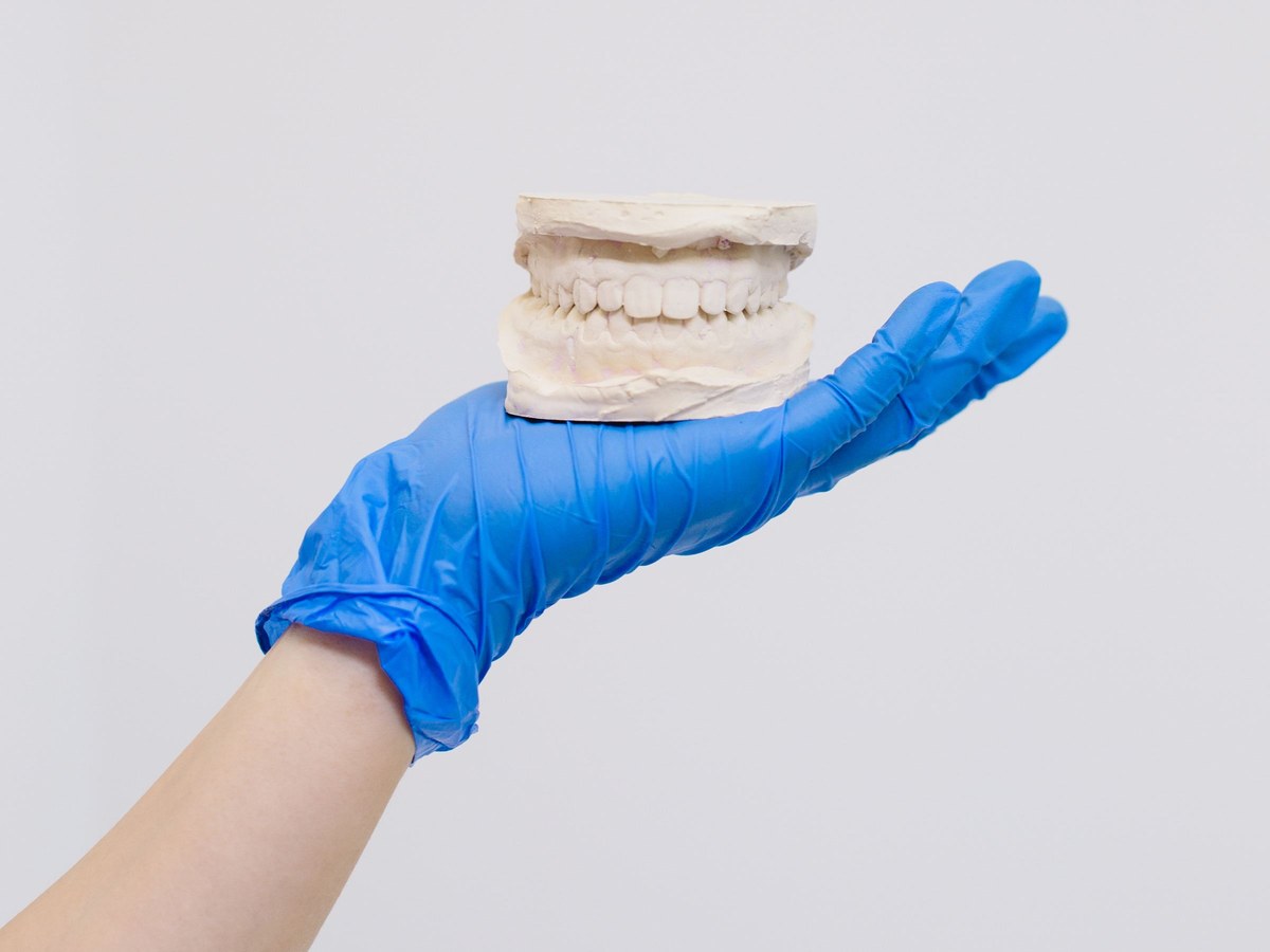 Gloved hand holding a plaster model of the teeth