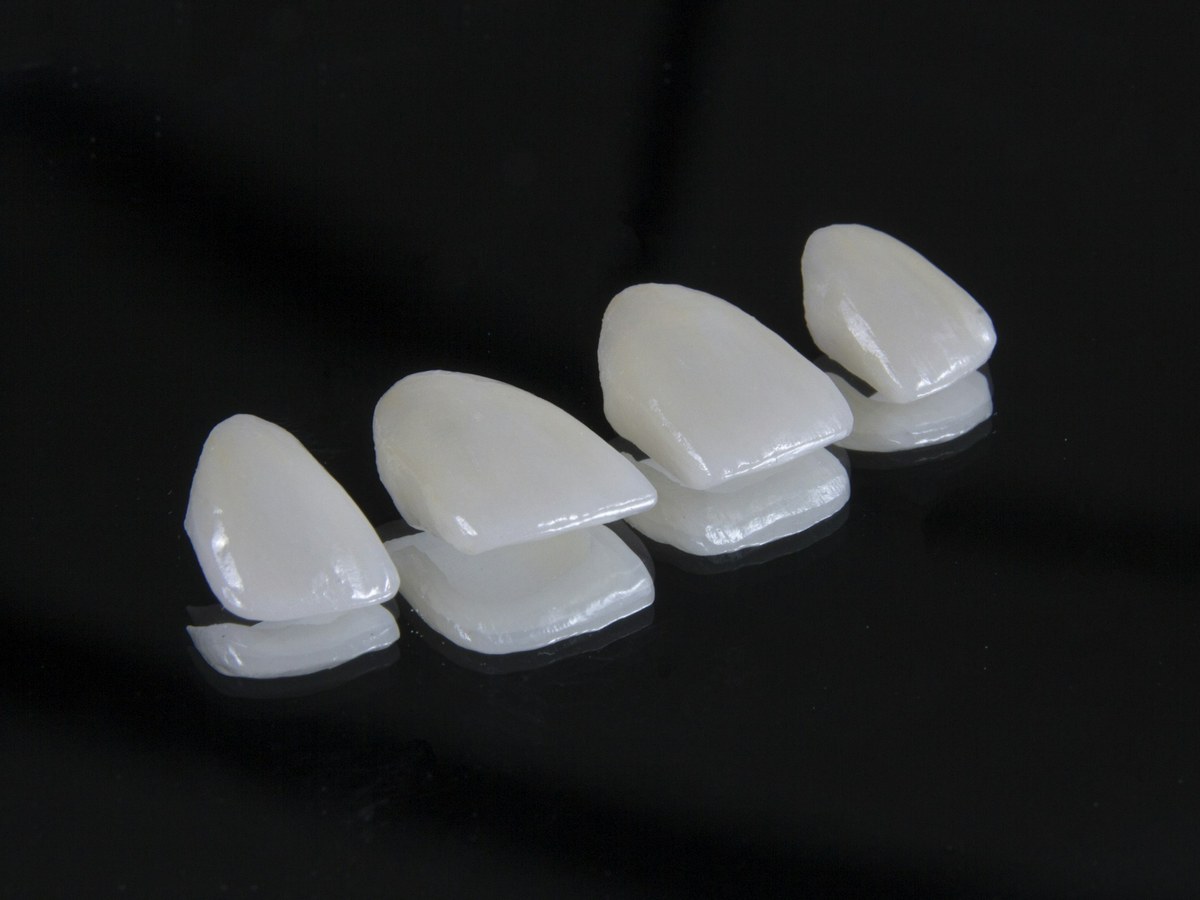 Porcelain dental restorations lined up on a dark surface