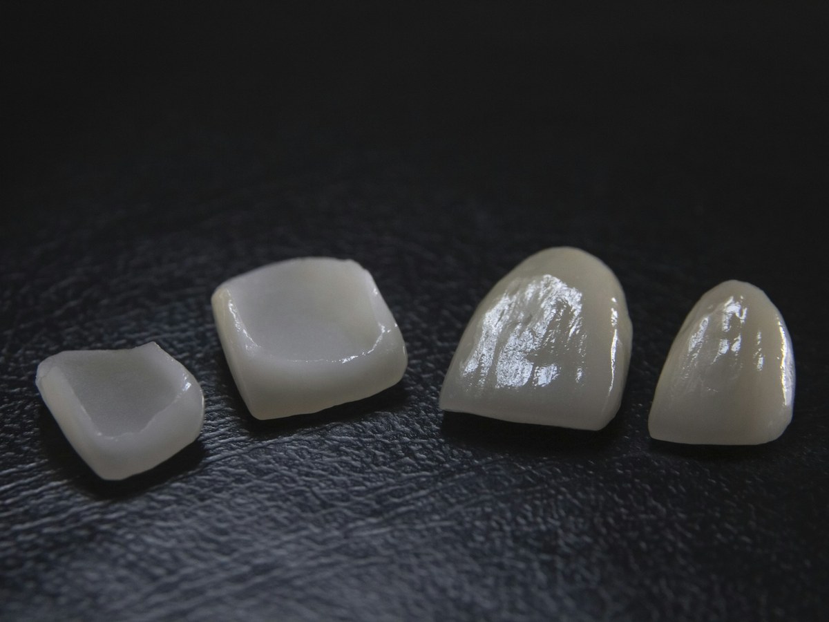 Porcelain veneer shells on a dark surface