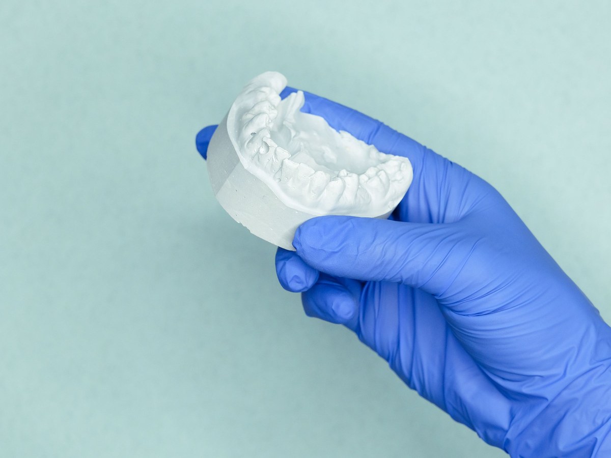Gloved hand holding a white stone model of the teeth