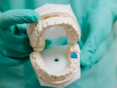 Gloved hands holding an open plaster cast of the upper and lower teeth