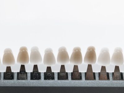 Row of tooth shade tabs used to compare tooth color