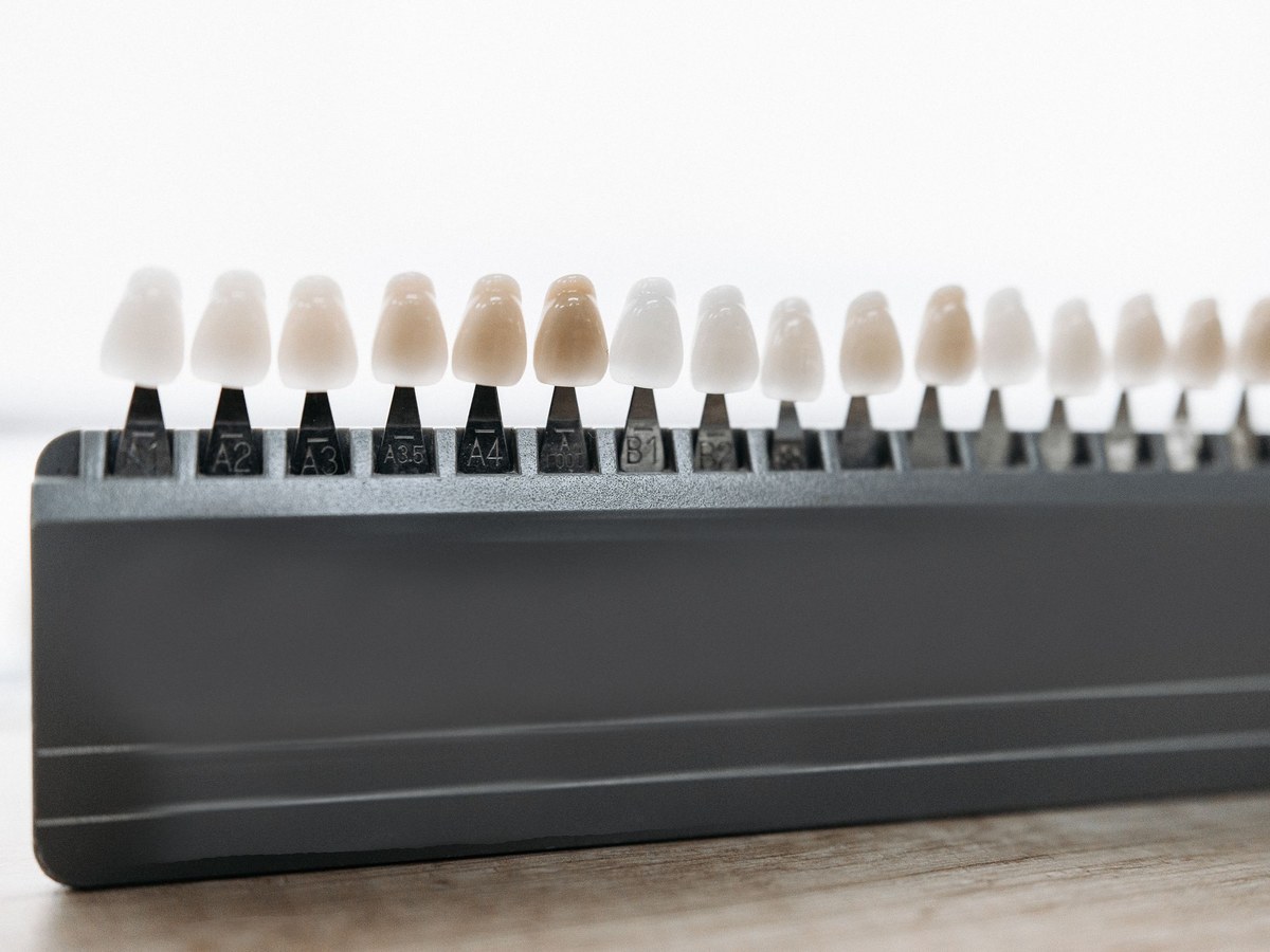 Tooth shade guide used to match the color of veneers