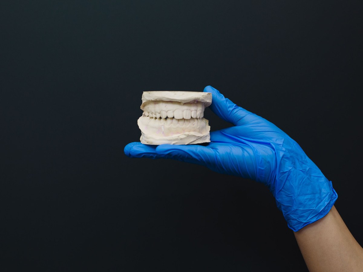 Gloved hand holding a plaster cast of the upper and lower teeth against a dark background