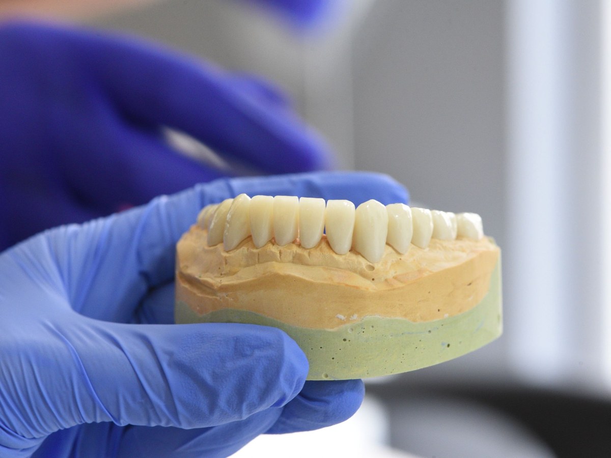 Gloved hand holding a dental model used to make a crown