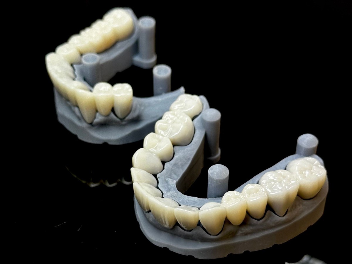 Two grey resin dental models with white teeth on a black reflective surface
