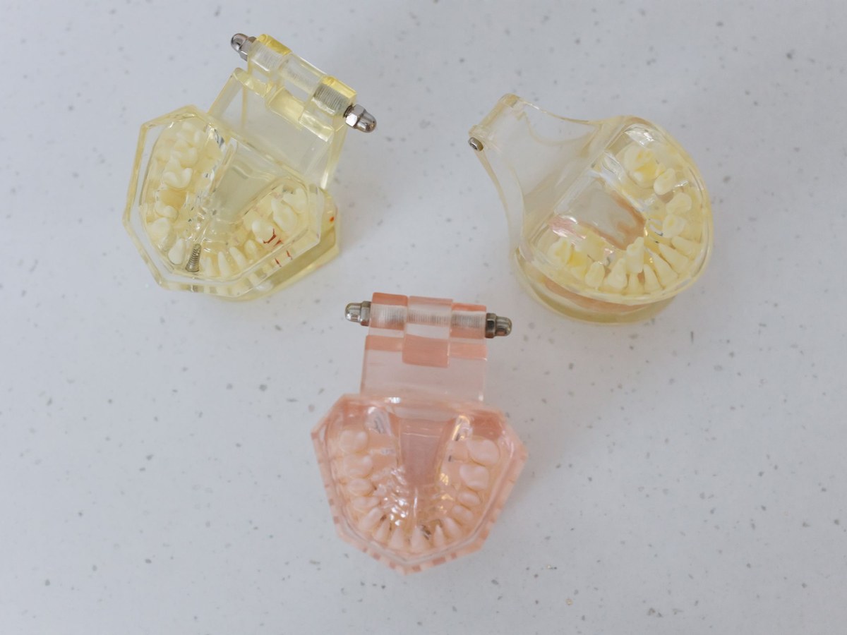 Three transparent dental models lying on a white speckled surface