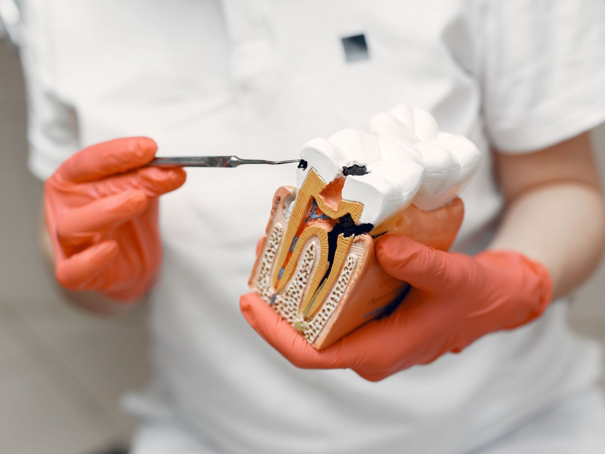 Gloved hands holding a cut-away model of a molar that shows the layers inside the tooth