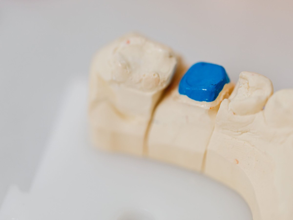 Stone model with a back tooth shaped and ready for a crown